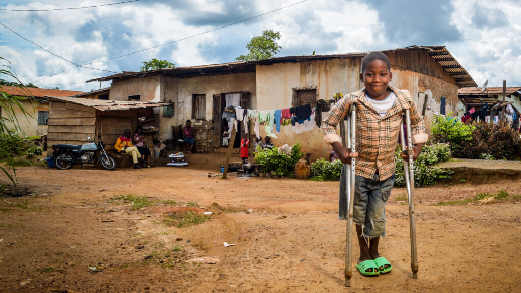 A young boy stands smiling outside his house assisted by crutches