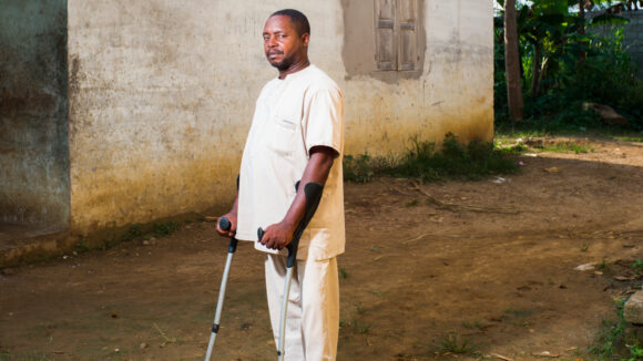 A man from cameroon is stood side on to the camera holding crutches in both hands